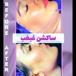 کلینیک تخصصی زیبایی سانی در هفده شهریور تبریز