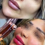 خدمات تخصصی ژل و بوتاکس نازنین سالاری در بندرعباس