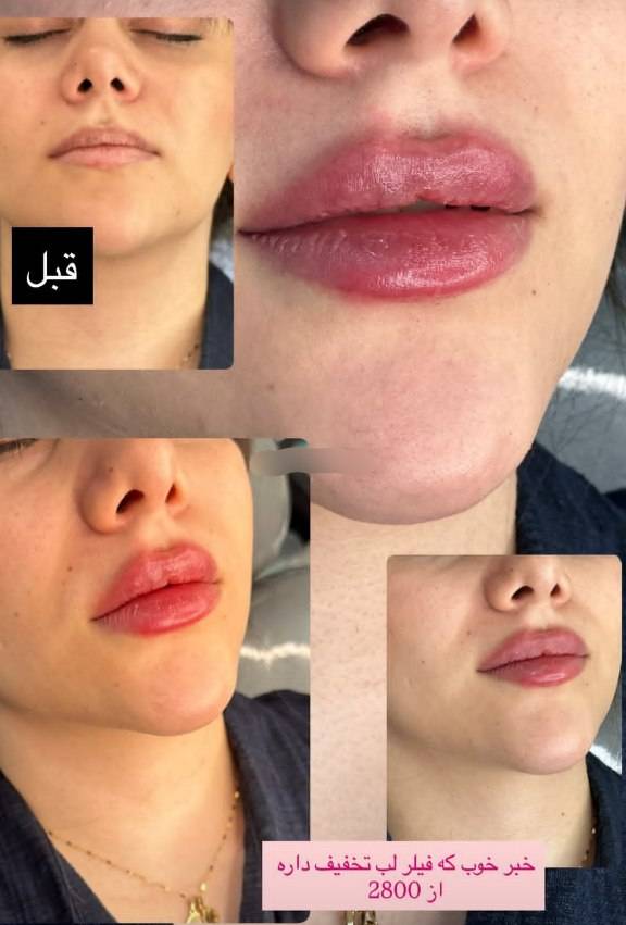 مشاهده کلینیک زیبایی ماهانا در ولیعصر سیرجان در سامانه بهبود مشاغل
