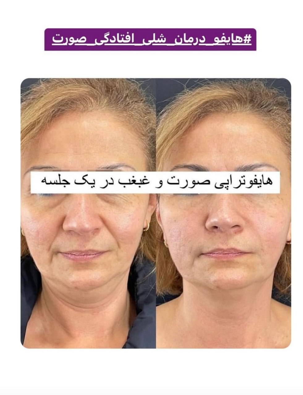 مشاهده کلینیک زیبایی ماهانا در ولیعصر سیرجان در سامانه بهبود مشاغل