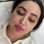 کلینیک زیبایی ماهانا در ولیعصر سیرجان
