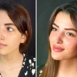 کلینیک زیبایی ماهانا در ولیعصر سیرجان