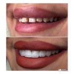 کلینیک تخصصی دندانپزشکی دی در بهبهان