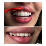 کلینیک تخصصی دندانپزشکی دی در بهبهان