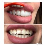کلینیک تخصصی دندانپزشکی دی در بهبهان