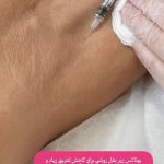کلینیک زیبایی و درمانی نیلوفر در ولیعصر تبریز
