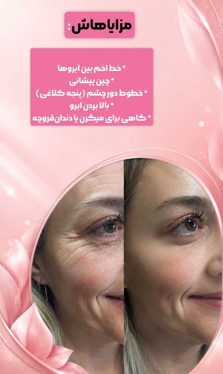 مشاهده آگهی کلینیک زیبایی و درمانی نیلوفر در ولیعصر تبریز در سامانه بهبود مشاغل