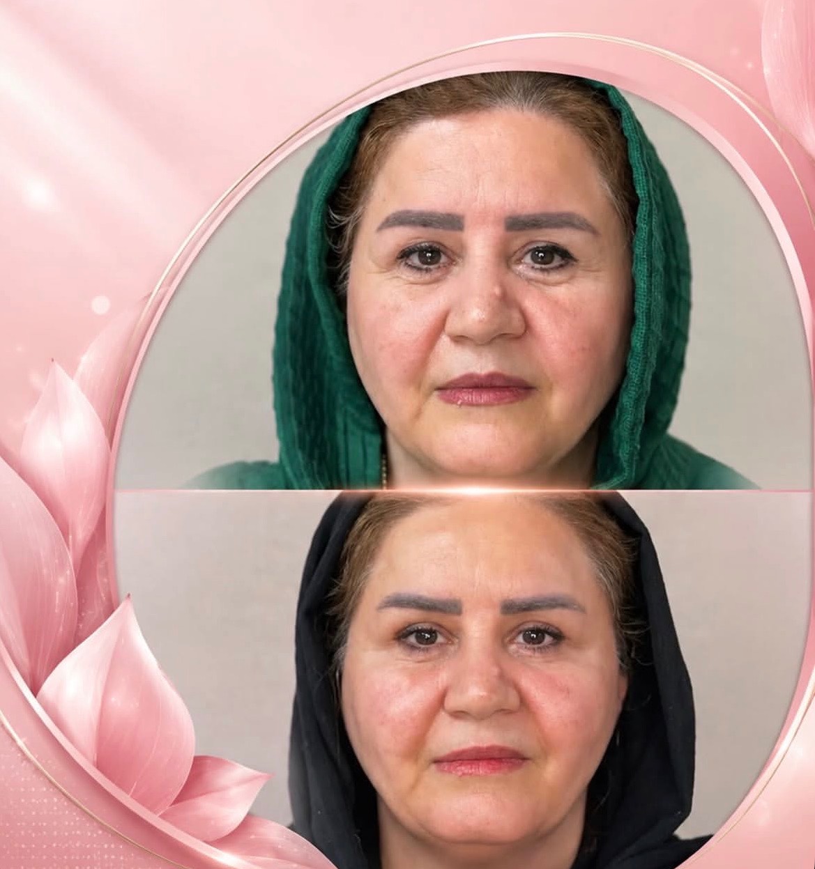 مشاهده آگهی کلینیک زیبایی و درمانی نیلوفر در ولیعصر تبریز در سامانه بهبود مشاغل
