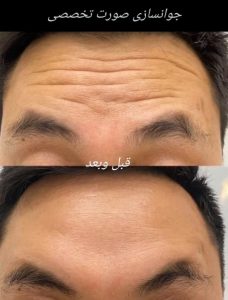 مشاهده کلینیک زیبایی پوست و مو آفتاب در باجک قم در سامانه بهبود مشاغل