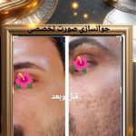کلینیک زیبایی پوست و مو آفتاب در باجک قم