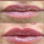 مرکز تخصصی لیزر دکتر مریم سلیمانی در باجک قم