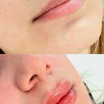 خدمات تخصصی ژل و بوتاکس حانی نیوفیس در شهر قدس