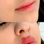 خدمات تخصصی ژل و بوتاکس حانی نیوفیس در شهر قدس