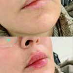خدمات تخصصی ژل و بوتاکس حانی نیوفیس در شهر قدس