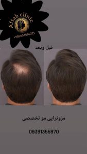 مشاهده کلینیک زیبایی پوست و مو آفتاب در باجک قم در سامانه بهبود مشاغل