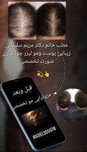 مشاهده کلینیک زیبایی پوست و مو آفتاب در باجک قم در سامانه بهبود مشاغل