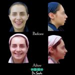 مطب تخصصی ارتودنسی دکتر هومن صدرحقیقی در ولیعصر تبریز