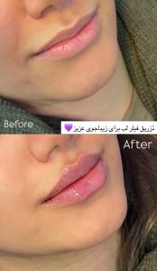 مشاهده کلینیک تخصصی پوست و لیزر دن در سلمان فارسی کازرون در سامانه بهبود مشاغل