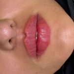 کلینیک تخصصی پوست و لیزر دن در سلمان فارسی کازرون