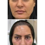 کلینیک تخصصی پوست و لیزر دن در سلمان فارسی کازرون