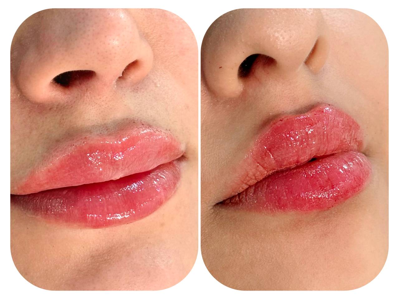 مشاهده خدمات تخصصی ژل و بوتاکس حانی نیوفیس در شهر قدس در سامانه بهبود مشاغل