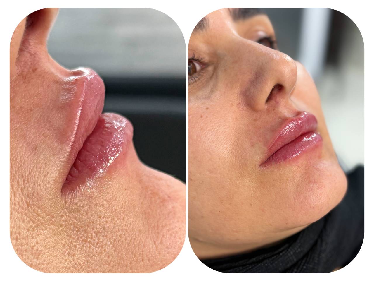 مشاهده خدمات تخصصی ژل و بوتاکس حانی نیوفیس در شهر قدس در سامانه بهبود مشاغل