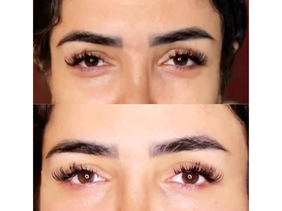 مشاهده خدمات تخصصی ژل و بوتاکس حانی نیوفیس در شهر قدس در سامانه بهبود مشاغل
