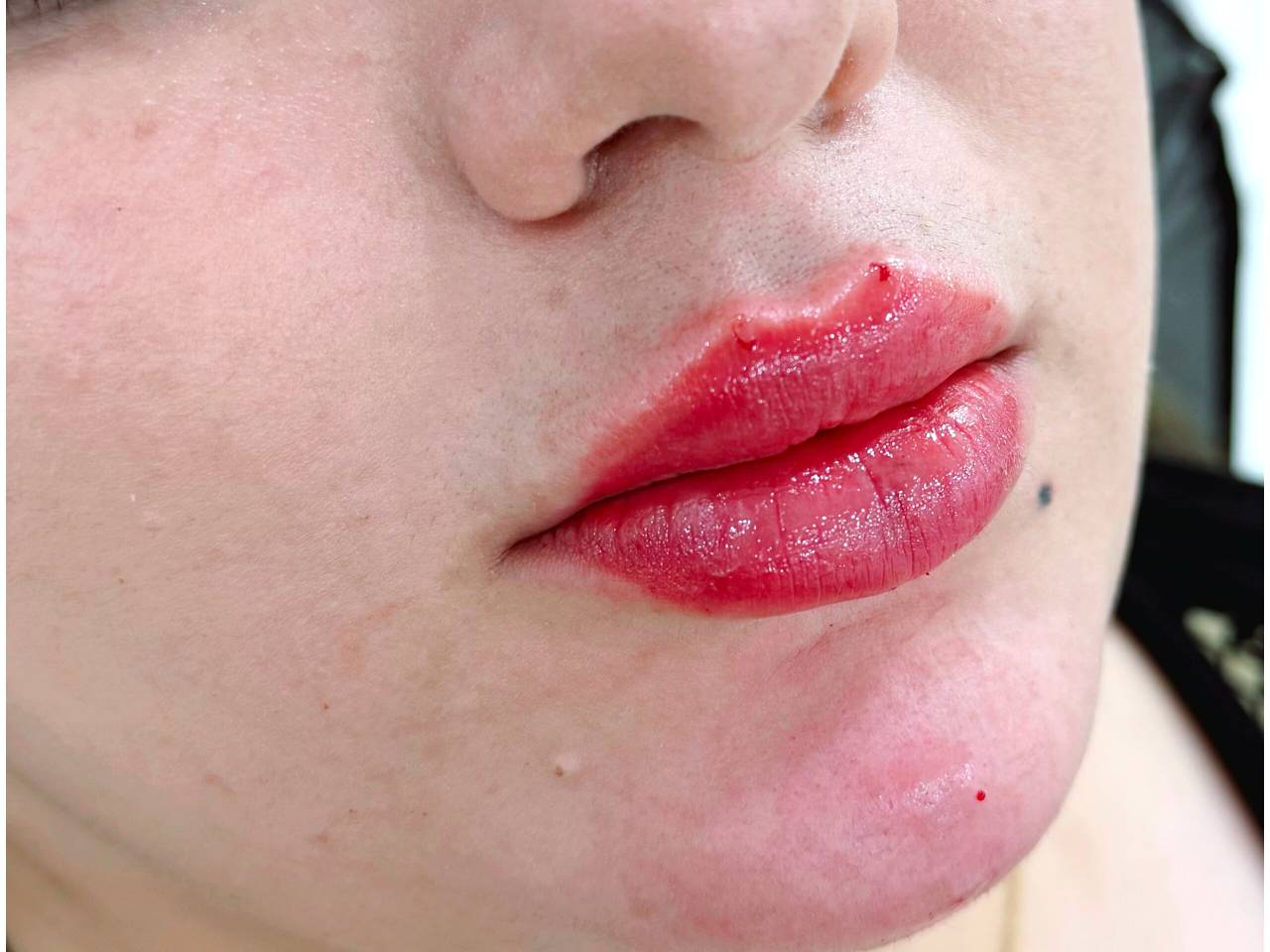 مشاهده خدمات تخصصی ژل و بوتاکس حانی نیوفیس در شهر قدس در سامانه بهبود مشاغل