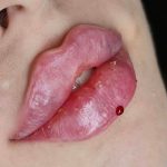 کلینیک زیبایی دکتر پریسا رشتچی در حسنی ارومیه