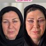 کلینیک زیبایی دکتر پریسا رشتچی در حسنی ارومیه