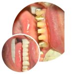 مطب دندانپزشکی دیجیتال در آمل