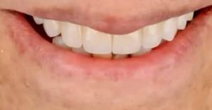مشاهده مطب دندانپزشکی دیجیتال در آمل در سامانه بهبود مشاغل