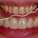 مطب دندانپزشکی دیجیتال در آمل