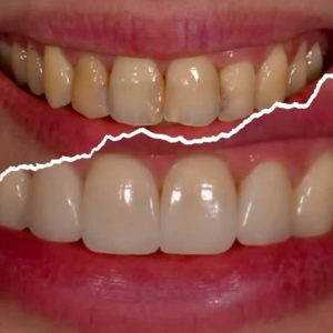 مشاهده مطب دندانپزشکی دیجیتال در آمل در سامانه بهبود مشاغل