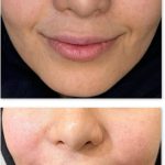 مطب زیبایی دکتر علیرضا گنجه فرد در بلوار مفتح قم
