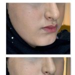 مطب زیبایی دکتر علیرضا گنجه فرد در بلوار مفتح قم