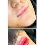 مطب زیبایی دکتر علیرضا گنجه فرد در بلوار مفتح قم