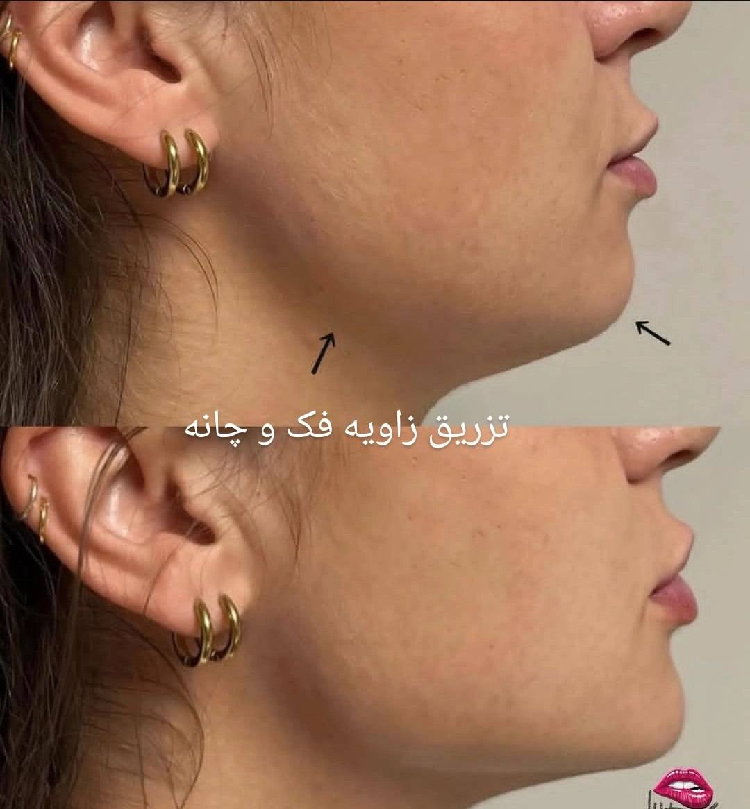 مشاهده آگهی کلینیک زیبایی لوتوس در کیان آباد اهواز در سامانه بهبود مشاغل