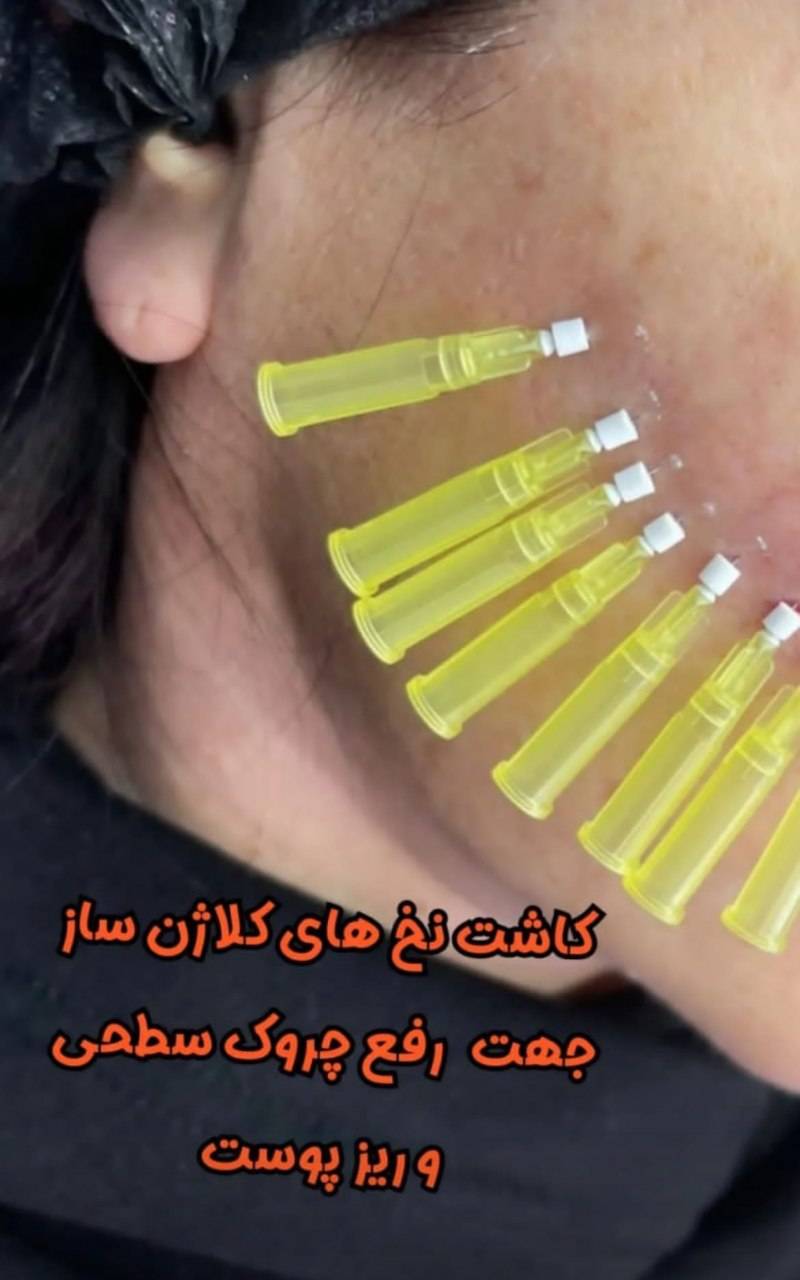 مشاهده آگهی کلینیک زیبایی لوتوس در کیان آباد اهواز در سامانه بهبود مشاغل
