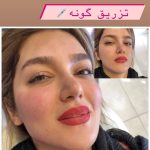 کلینیک زیبایی لوتوس در کیان آباد اهواز