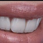 مطب دندانپزشکی رایادنتال در باغ فیض اسلامشهر