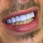 مطب دندانپزشکی رایادنتال در باغ فیض اسلامشهر