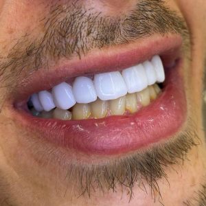 مشاهده مطب دندانپزشکی رایادنتال در باغ فیض اسلامشهر در سامانه بهبود مشاغل