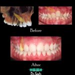 مطب تخصصی ارتودنسی نامرئی و شفاف دکتر هومن صدرحقیقی در تبریز