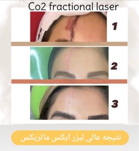 مشاهده کلینیک زیبایی موون moon در چهارباندی بوشهر در سامانه بهبود مشاغل