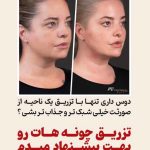 کلینیک زیبایی موون moon در چهارباندی بوشهر