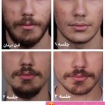 کلینیک زیبایی موون moon در چهارباندی بوشهر