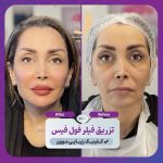 کلینیک زیبایی موون moon در چهارباندی بوشهر