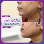 کلینیک زیبایی موون moon در چهارباندی بوشهر