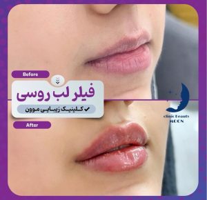 مشاهده کلینیک زیبایی موون moon در چهارباندی بوشهر در سامانه بهبود مشاغل
